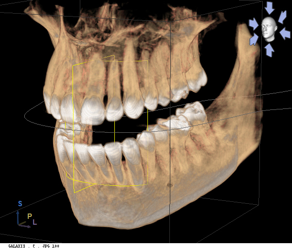 Dental Xrays | Dentists | Marion IL